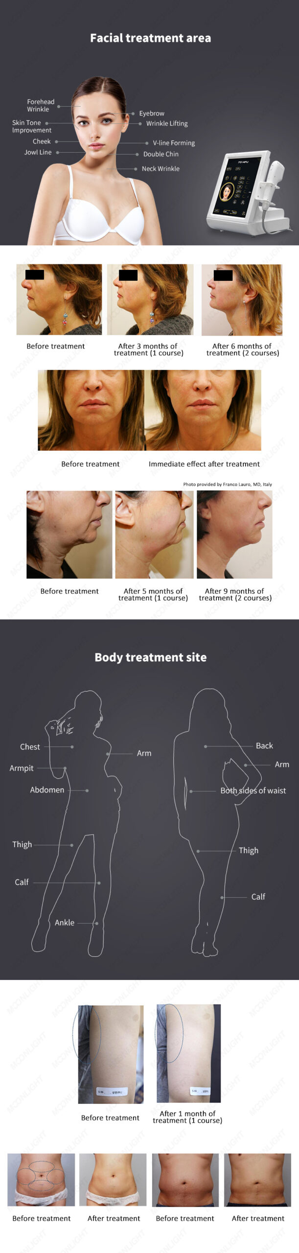 Facial-effects1